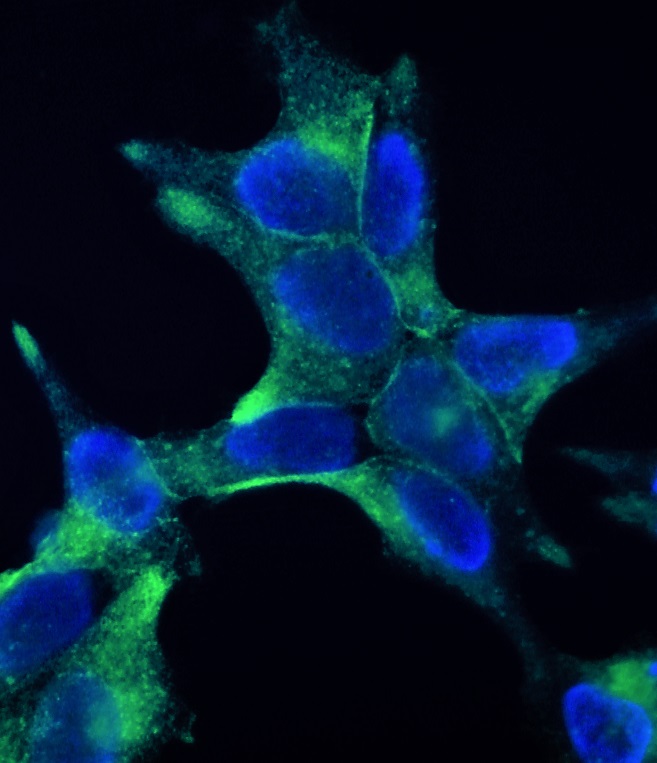 Figure 4. Indirect immunofluorescence staining of PSMA in the prostate cancer cell line LNCaP cells using MUB1510P, clone 107-1A4 (diluted 1:500). Note the membranous localization of PSMA. Nuclear DNA staining with DAPI.